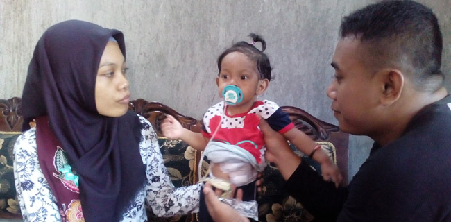 Denok Bayi Tanpa Saluran Kerongkongan