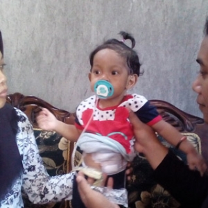 Denok Bayi Tanpa Saluran Kerongkongan