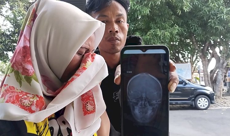 Ibu korban penganiayaan Wahyuni (45) sambil menahan tangis, beserta Yudi saat menunjukkan hasil rongen OK kepada wartawan, Kamis (8/8). Erna Yunus B/RMOLJateng