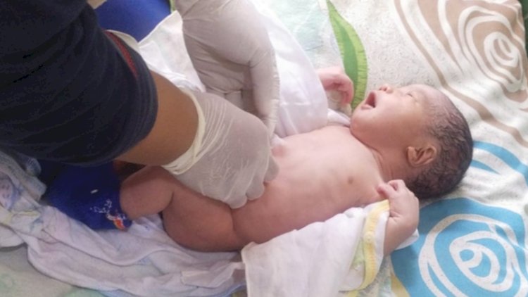 Bayi cantik yang diduga sengaja dibuang di hutan Tambakselo saat dilakukan pemeriksaan oleh petugas medis, Kamis (19/9) siang. Rubadi/RMOLJateng.